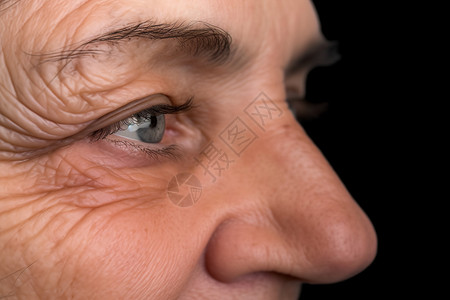 眼部的皱纹背景图片