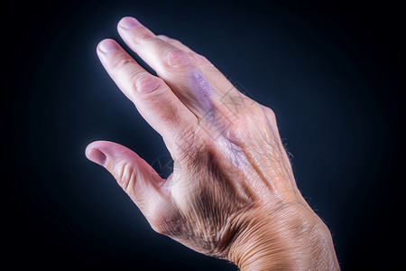 手部疾病背景图片