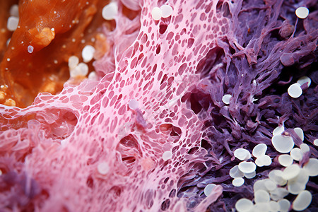 肝纤维化微观的生物组织设计图片