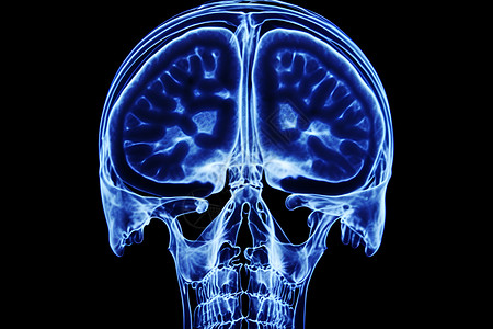 磁共振成像蓝色头部医学影像设计图片