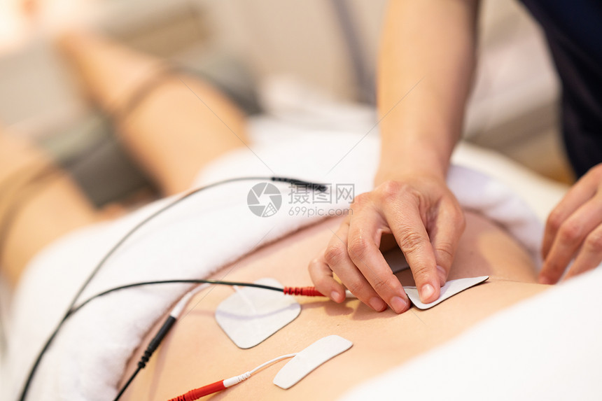 物理治疗师物理治疗中年轻女性应用电刺激年轻女性进行物理治疗中的电刺激图片