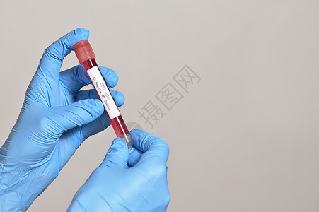 冠状病毒2019年NCOV血试验阳性图片