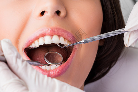 牙科医生的口腔检查期间的张口特写牙医的牙科检查图片