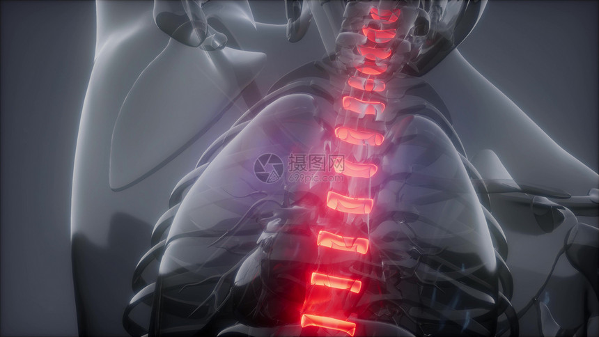 伤了脊椎男骨干背痛头痛椎骨疼痛伤了脊椎男骨干背痛图片