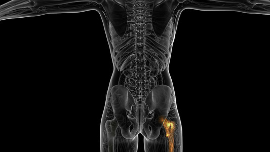 髋骨解剖医学扫描图片