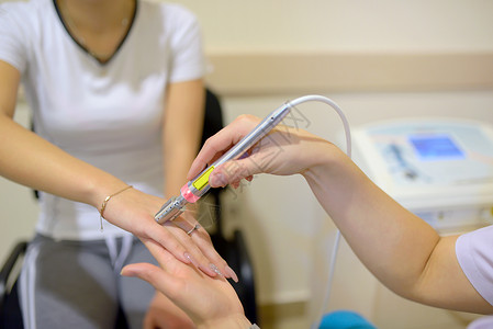 轻女子手腕手接受激光治疗高清图片