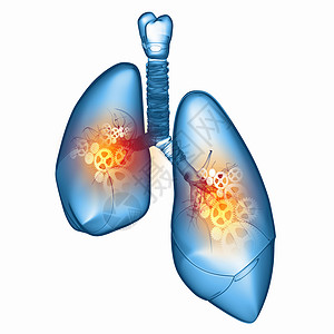 人类的肺机制的人肺健康医学背景图片