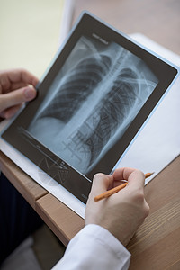 医生手医疗办公室着胸部肺部X光的特写图片