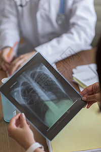 自信的医生医院咨询妇女解释胸部X线扫描的结果图片