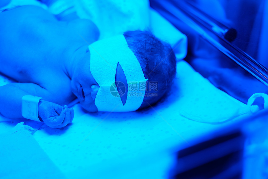 两天大的新生婴儿蓝色紫外线下拍照图片