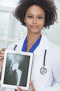 位非裔美国女医生医院里着台平板电脑,屏幕上位髋关节置换病人x光图片