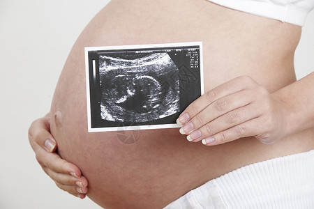 密切孕妇抱着婴儿扫描图片