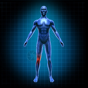 人体膝盖疼痛需要手术与网格个意外的医疗姿势的关节蓝色黑色的背景图片