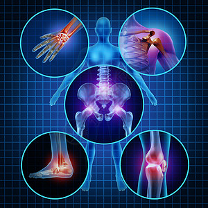 疼痛关节人体解剖,身体圆形板的疼痛区域,疼痛伤害关节炎疾病的象征,医疗保健医疗症状,由于衰老运动工伤背景图片