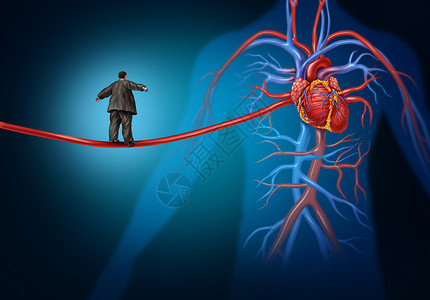 人血白蛋白心脏病危险的危险因素种医疗保健生活方式的,超重的人走拉长的动脉高线上,冠心病危险高血压的象征背景