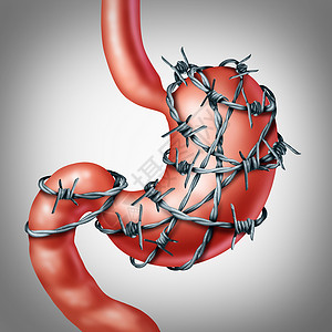 胃十二指肠溃疡腹泻问题高清图片