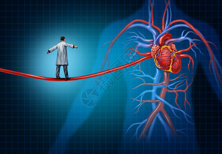 心脏手术的心脏外科医生行走条形状为高钢丝绳的动脉上,种心脏病内部心血管器官心脏病学的医学理念背景图片