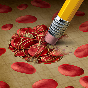 血液ICON血液凝块血栓治疗除凝块的铅笔橡皮擦,擦除由粘血小板纤维蛋白堵塞的危险堵塞,外科医疗治疗循环疾病的图标背景
