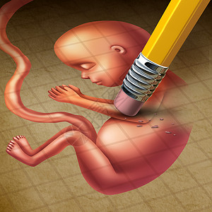 子宫切除手术堕胎流产医学,如怀孕的人子宫中的胎儿被铅笔抹,生殖健康损失的比喻,终止妊娠背景