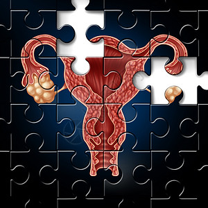 子宫颈生育挑战孕医学符号个完整的谜题与子宫的图像与输卵管妇科图标女生殖问题的三维插图风格背景