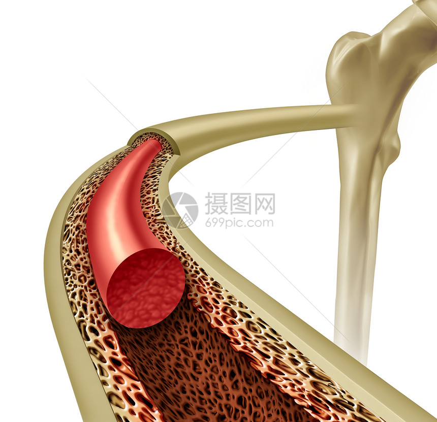 骨髓健康骨质疏松症的,个健康的解剖与强大的正常个图标骨科骨科与三维插图元素图片