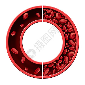静脉输液器贫血贫血医学图的正常异常的血细胞计数人动脉静脉中的循环,白色背景上分离的三维图背景