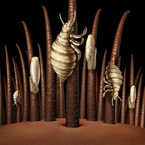 头发上的虱子个医学问题的,放大了个人的头,寄生的虱子卵虱子昆虫孵化出来,感染治疗的象征背景图片