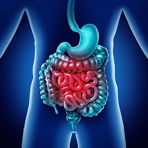 肠痛胃内消化炎症问题消化适便秘感染A3D插图图片