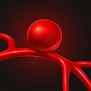 动脉瘤的医学种医学符号,用于症状诊断血管膨胀成气球的形状,破裂的风险三维图示背景图片