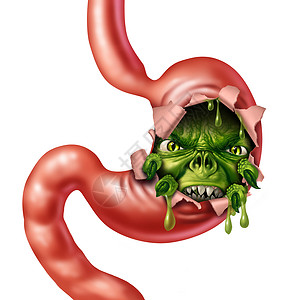医学隐喻消化良腹痛与胃液流感呕吐三维插图元素背景图片