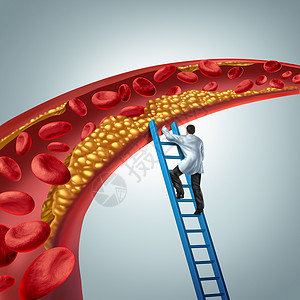 脂类胆固醇医学诊断名医生,调查动脉粥样硬化动脉斑块堵塞动脉与三维渲染元素背景