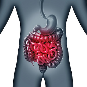 肠肠疼痛胃内消化炎症问题消化适便秘感染A3D插图图片
