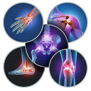 人体手脚人体疼痛关节的与骨骼解剖的身体与疮与发光的关节疼痛伤害关节炎疾病的象征,保健医疗症状背景