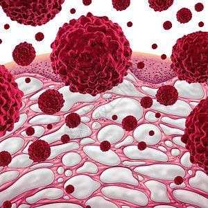 细胞蛋白间质癌症结缔,与填充液体的比较个微观的人体部分与恶细胞三维插图风格间质癌症背景