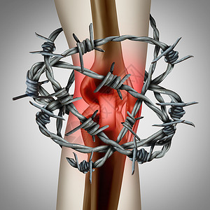 刺穿的关节人体骨骼疼痛的医学插图插画