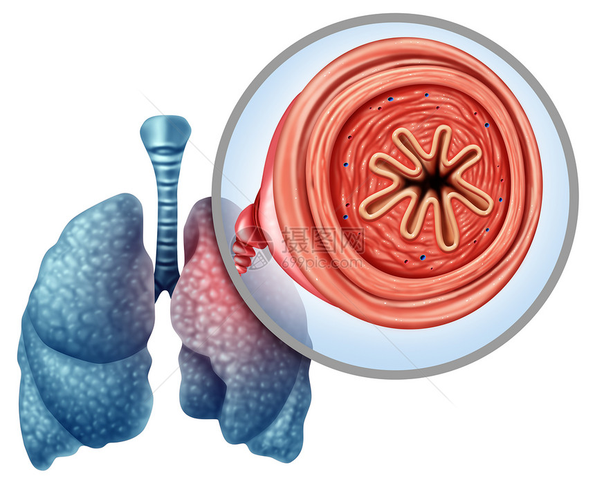 肺气肿的医学与三维插图元素图片