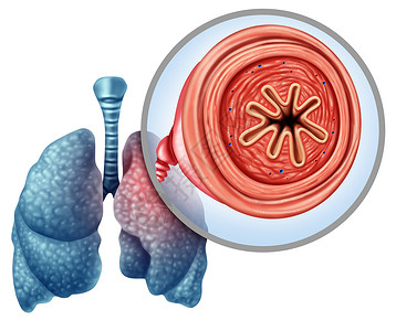 慢肺阻肺气肿的医学与三维插图元素背景