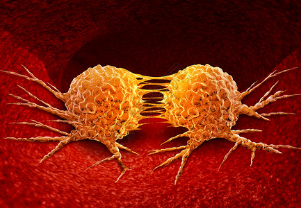 癌变将癌细胞移分裂种疾病解剖,人体内器官上生长的恶肿瘤,三维图示分裂癌细胞背景