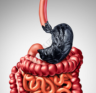 人类消化问题个胃,形状为垃圾袋,肠道器官消化系统消化良疼痛的象征,医学上的例子人类消化问题背景图片