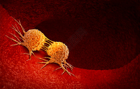 肿瘤靶向治疗癌细胞分裂治疗由致癌物遗传学引的人体恶癌细胞,以癌细胞为免疫治疗符号,以医学治疗为三维图示背景