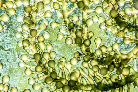 微藻科富含脂肪的碱催化高清图片