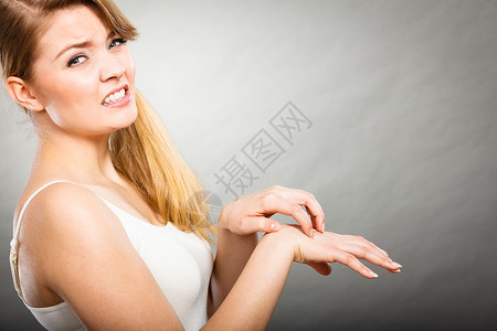 皮肤科,过敏健康问题轻的女抓着她瘙痒的手掌过敏皮疹女挠痒的手掌过敏皮疹背景图片