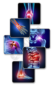 三维人体人体关节疼痛骨骼肌肉解剖的身体与疼痛的关节疼痛的伤害关节炎疾病的象征,保健医疗症状与三维插图元素背景
