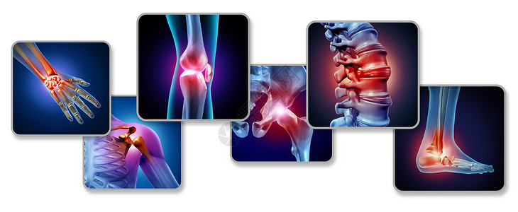 关节疼痛的骨骼肌肉解剖三维插图元素背景图片