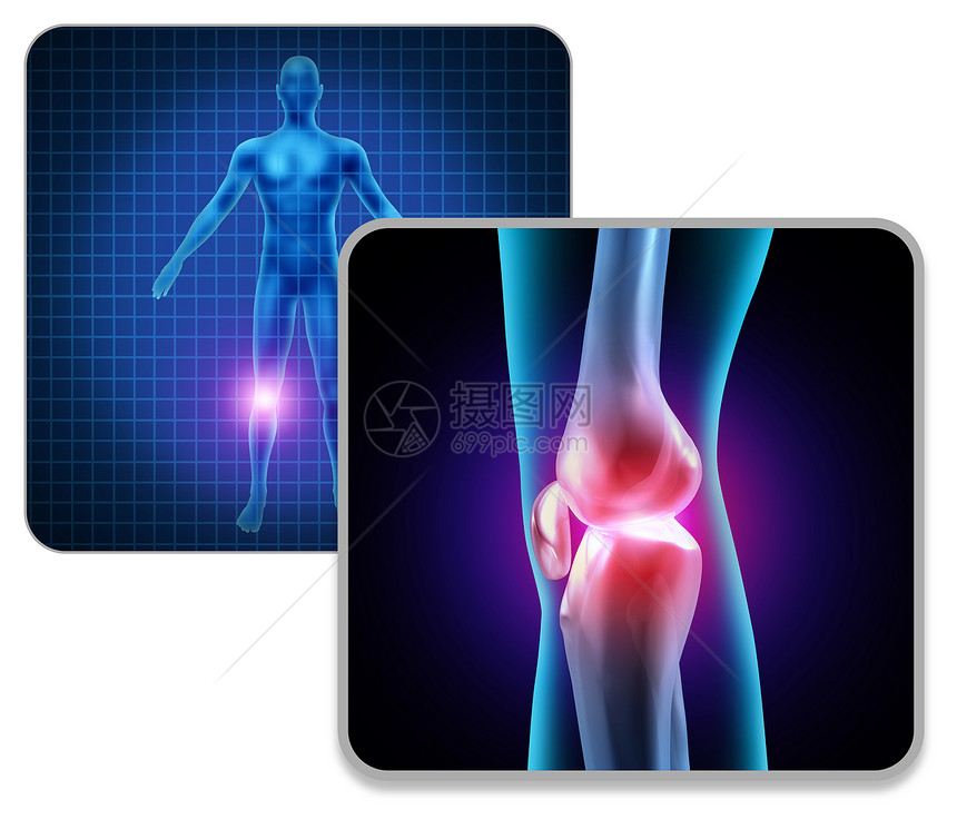 人体膝关节疼痛骨骼肌肉解剖的三维插图元素图片