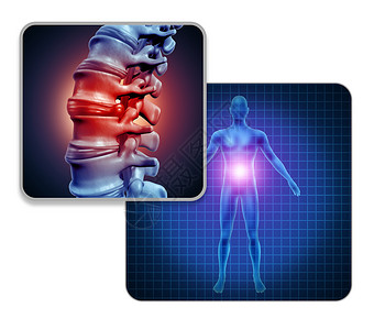 背部骨骼人背部关节疼痛的骨骼肌肉解剖的身体与疼痛的脊柱关节疼痛的巴赫伤害关节炎疾病的象征与三维插图元素背景