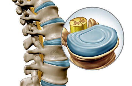 元素放大倍数腰椎盘解剖节段医学,人体背部骨骼的特写,脊椎放大,脊髓椎间盘三维插图分离白色背景