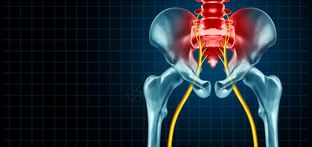 坐骨神经疼疝出解剖学高清图片