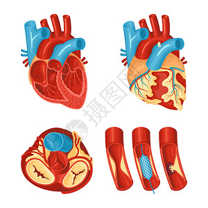 白色背景矢量插图上分离的健康疾病的心脏平集的解剖图片