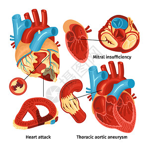 平图标与心脏解剖同类型的疾病隔离白色背景矢量插图高清图片